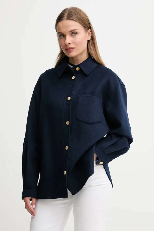 Tommy Hilfiger Jakna z dodatkom volne Tommy Hilfiger